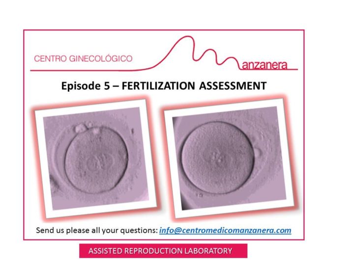 EPISODE  5. FERTILIZATION ASSESSMENT WITHIN ASSISTED REPRODUCTION TREATMENTS (IVF-ICSI)