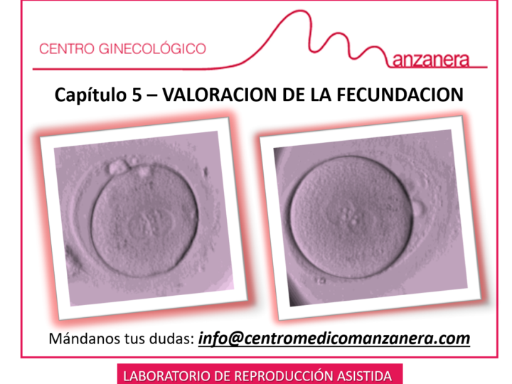 CAPITULO 5. VALORACION DE LA FECUNDACION EN LOS TRATAMIENTOS DE REPRODUCCION ASISTIDA (FIV-ICSI)