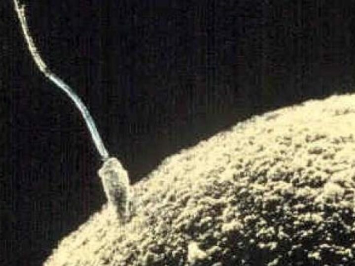 Ropa Methode In FertilitÄtsbehandlungen Centro Médico Manzanera