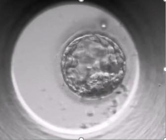 VORTEILE DES „TIME-LAPSE“ (ZEITRAFFER) BEI ASSISTIERTER REPRODUKTION (IVF-ICSI)