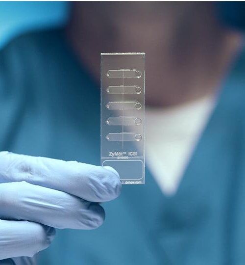 SPERMA-DNA-FRAGMENTIERUNGS-CHIPS BEI ASSISTIERTEN REPRODUKTIONSBEHANDLUNGEN (IVF-ICSI)