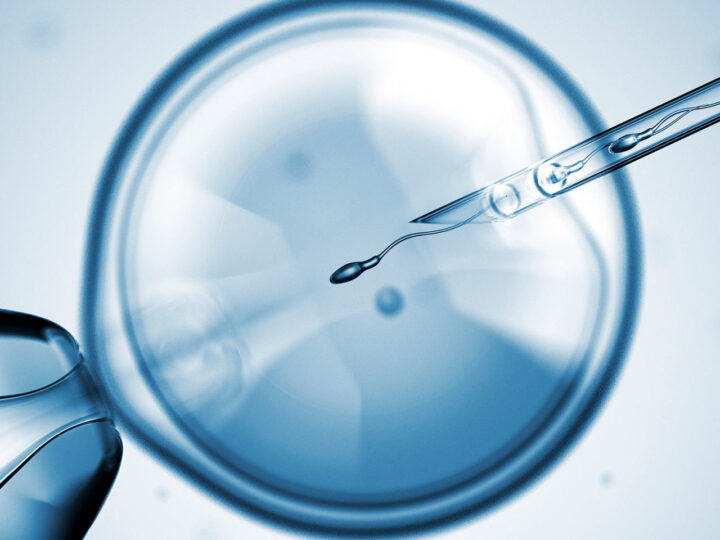 UPCOMING ADVANCES IN ASSISTED REPRODUCTION
